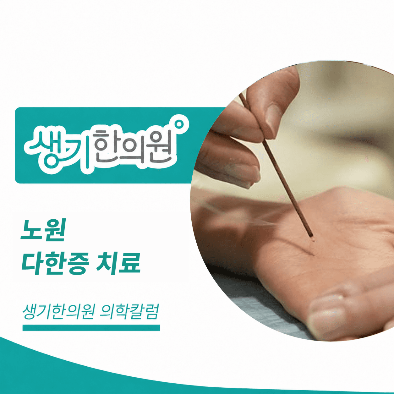 생기한의원 노원점 다한증 치료 의학칼럼 표지와 피부 진료 참고 사진