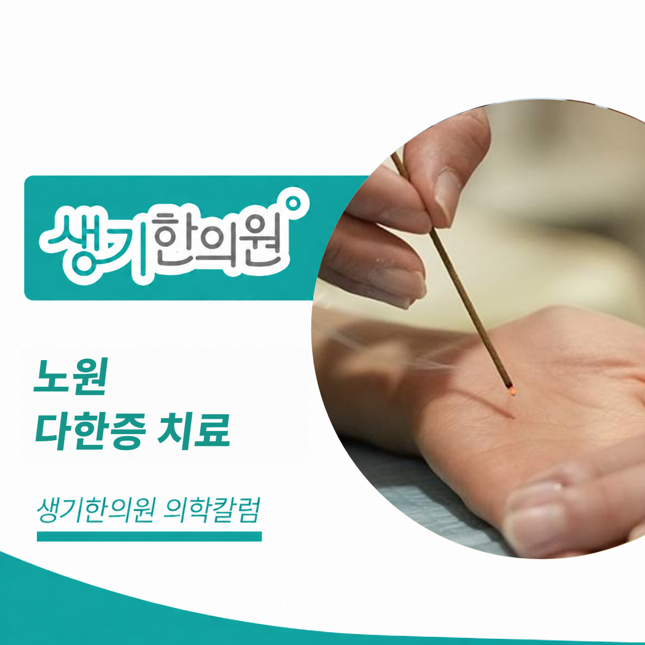 생기한의원 노원점 다한증 치료 의학칼럼 표지와 피부 진료 참고 사진